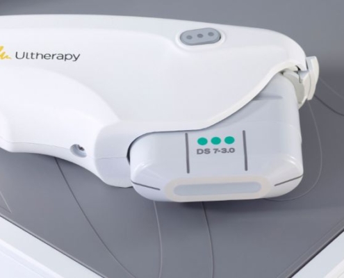 Domande più frequenti su Ultherapy PRIME®